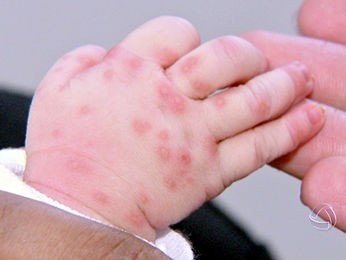 Em SC: Criança de 3 anos é levada em estado crítico para hospital