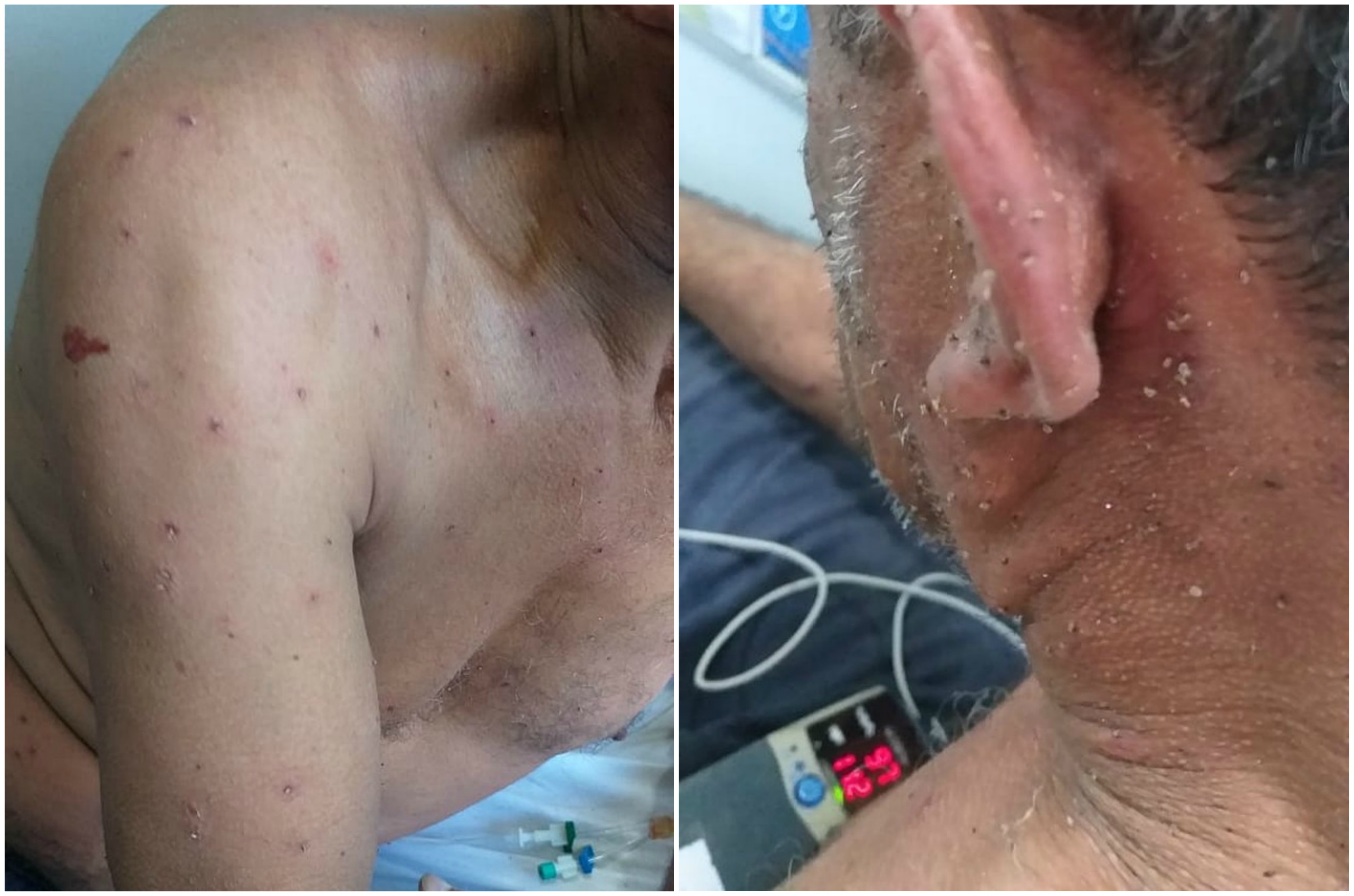 No Estado: Homem leva mais de 200 picadas de abelhas