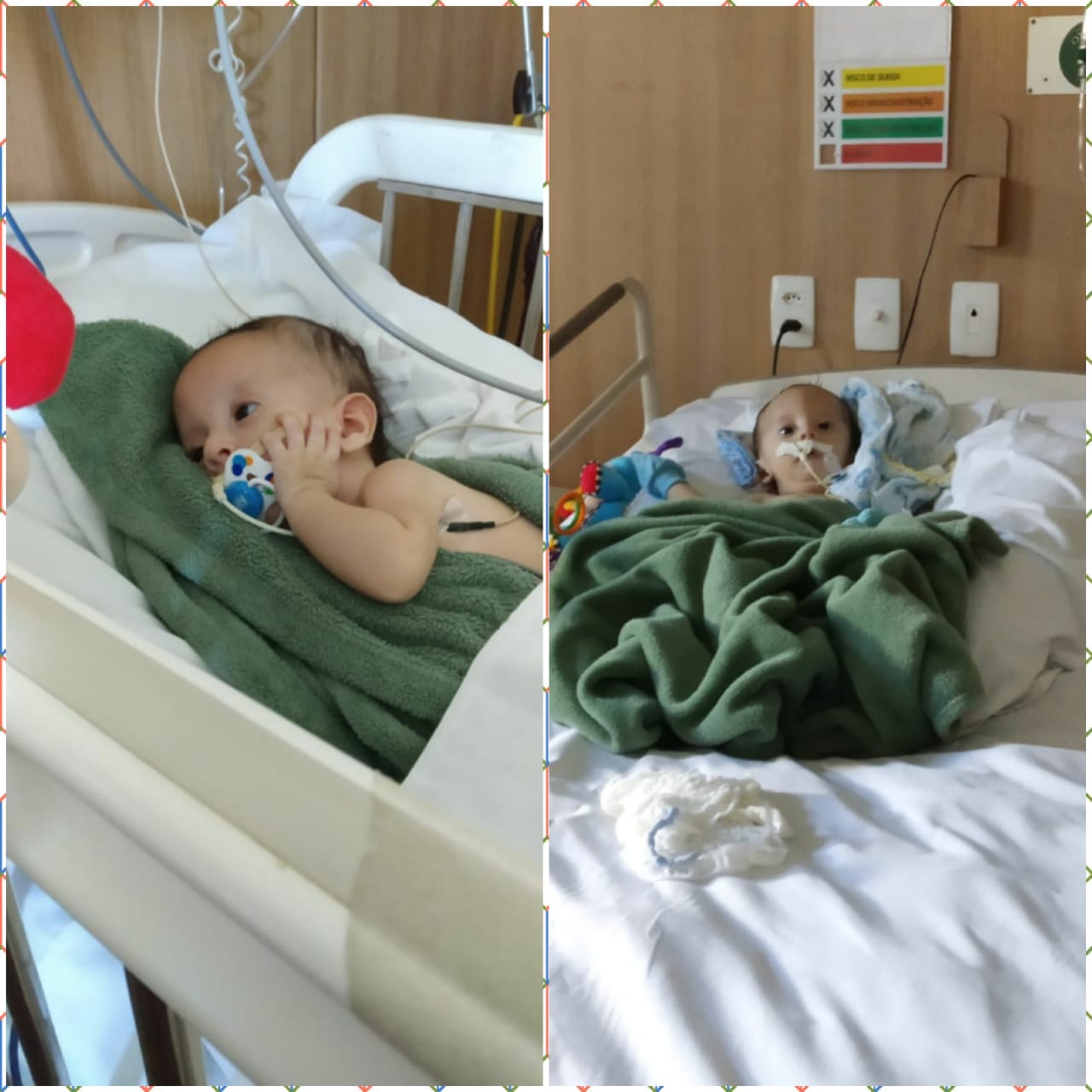 Você pode ajudar! Benjamin nasceu com hidrocefalia