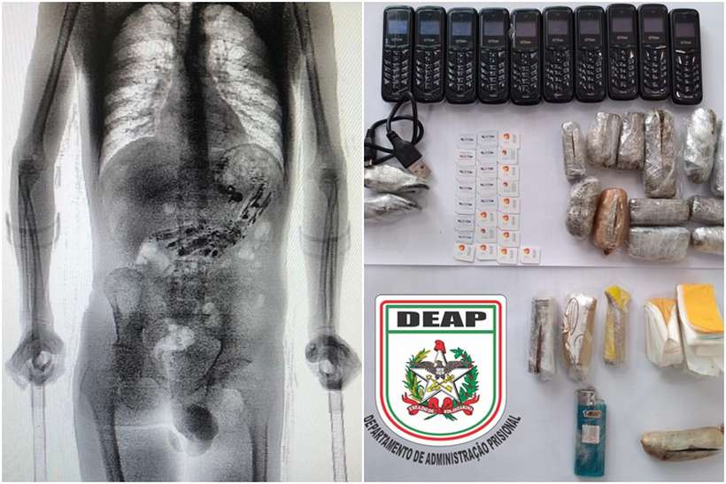 No Estado: Detento tenta entrar na cadeia com nove celulares e 52 objetos no estômago