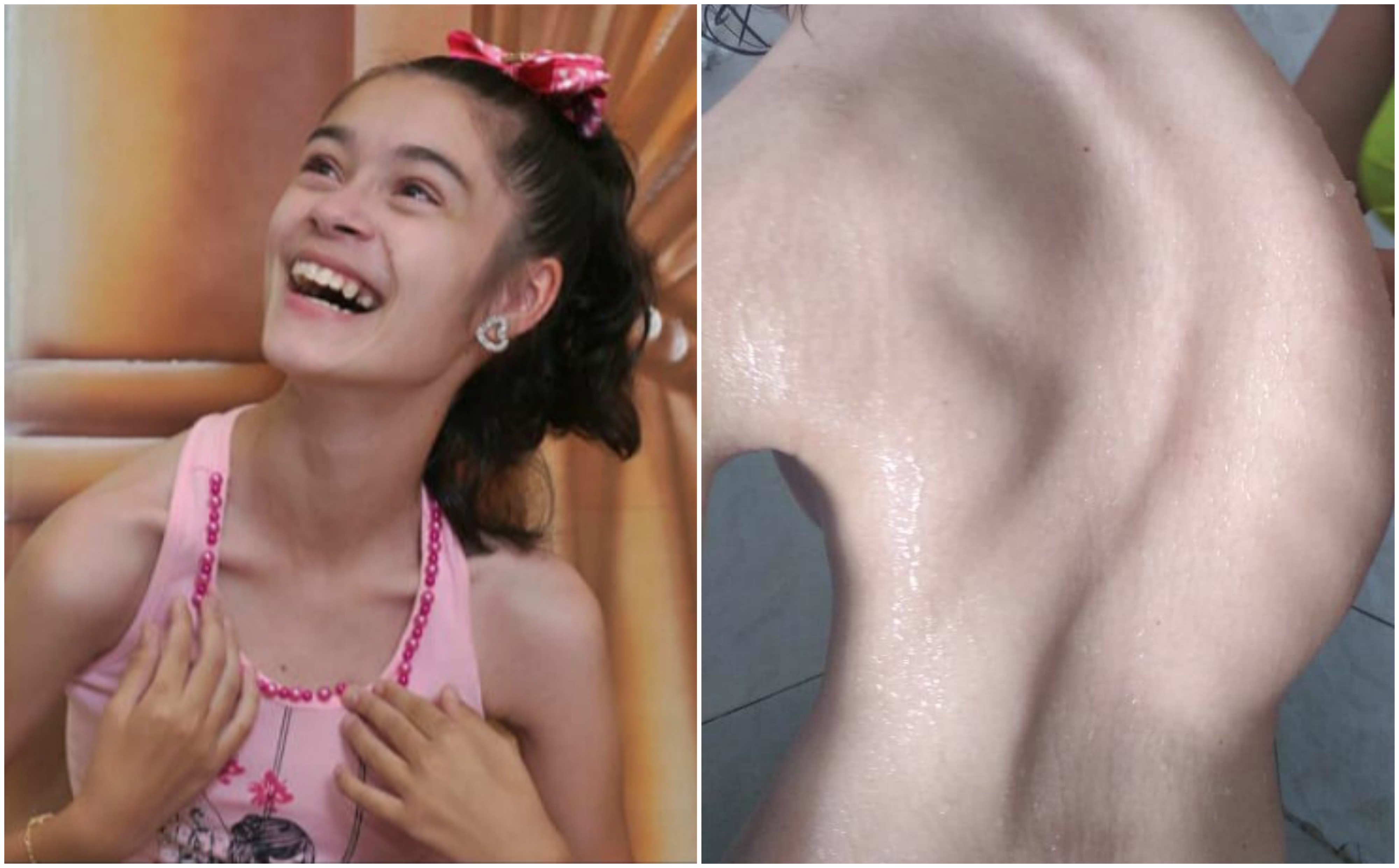 Corrida contra o tempo: Adolescente precisa de ajuda para fazer cirurgia emergencial