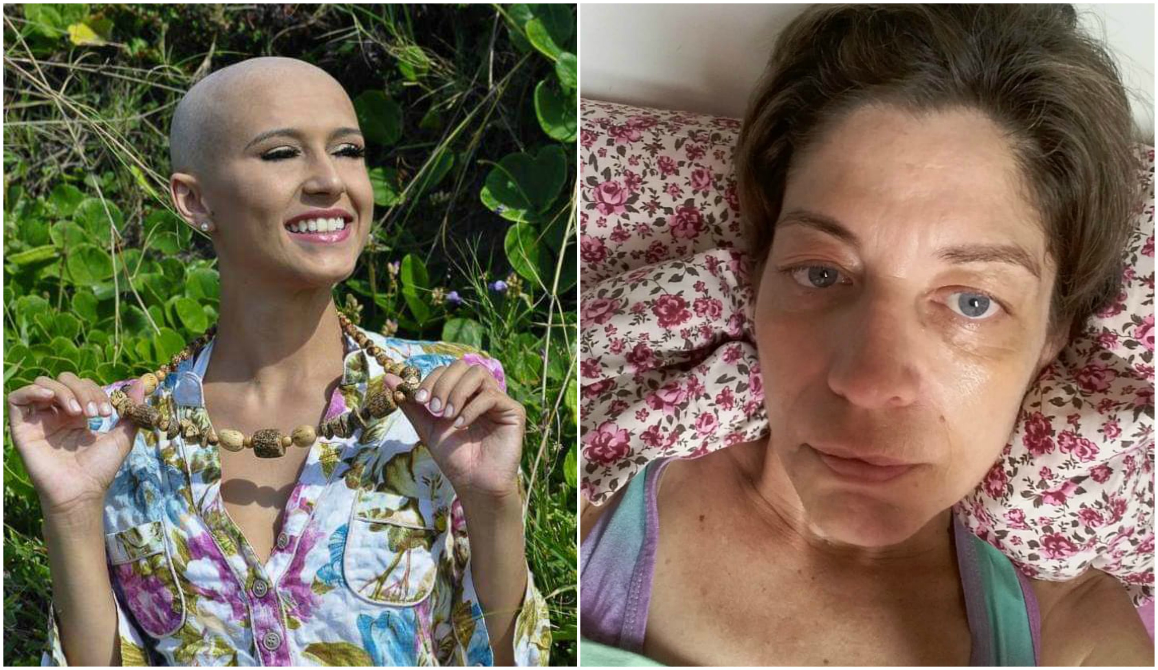 Unidas contra o câncer: Amigas buscam apoio para tratamento de cerca de R$ 37 mil