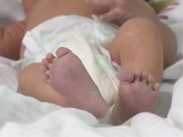 Bebê dado como morto volta a respirar quando família se despedia