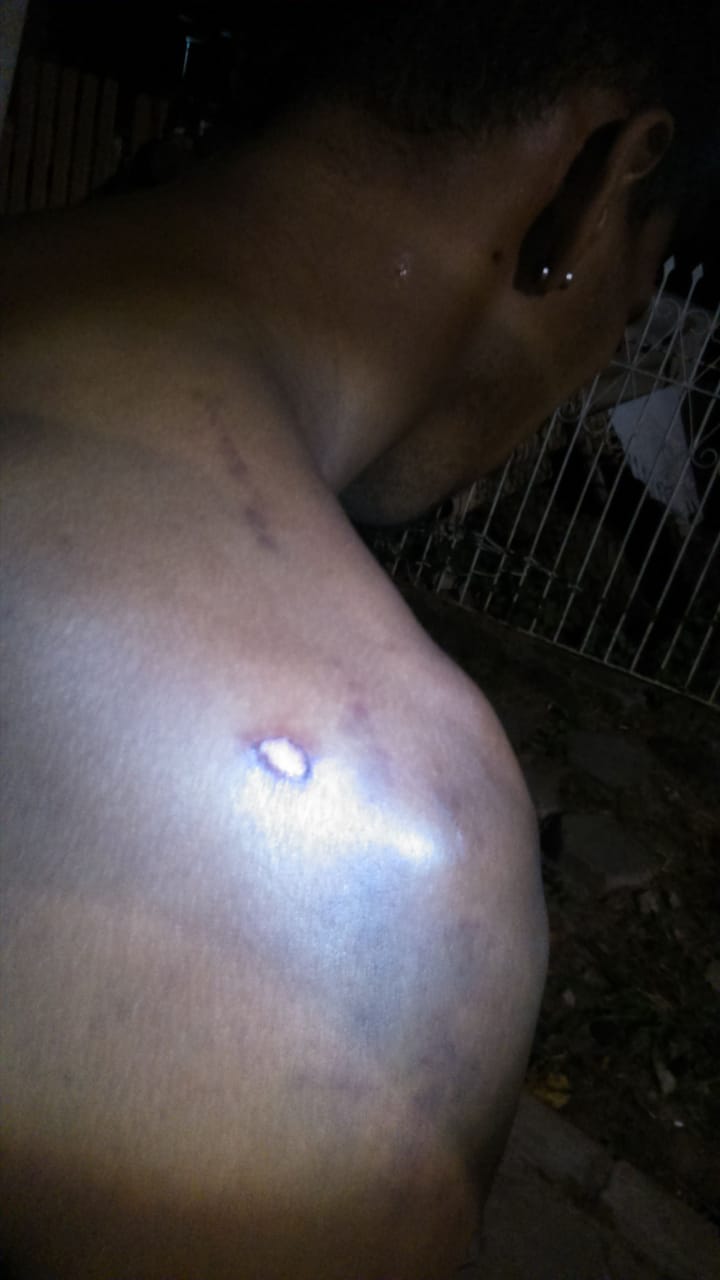 Em SC: Adolescente de 17 anos sofre tentativa de estupro; jovem reage, morde bandido e consegue fugir