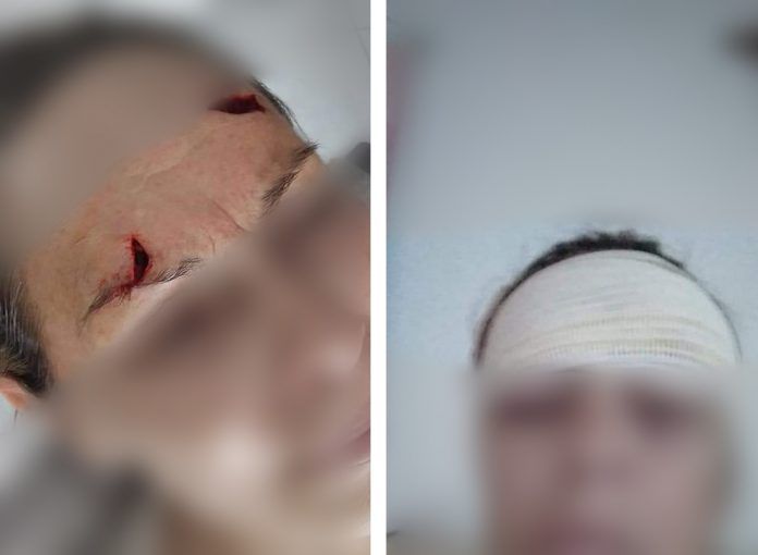 Filho é suspeito de agredir mãe de 63 anos em Laguna