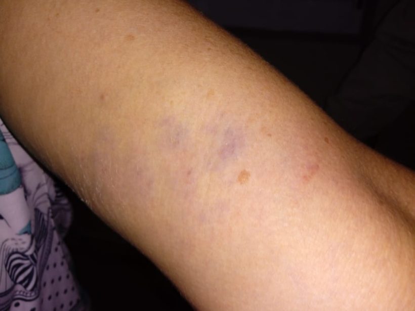 Mulher é assaltada no momento em que saía do serviço em Araranguá