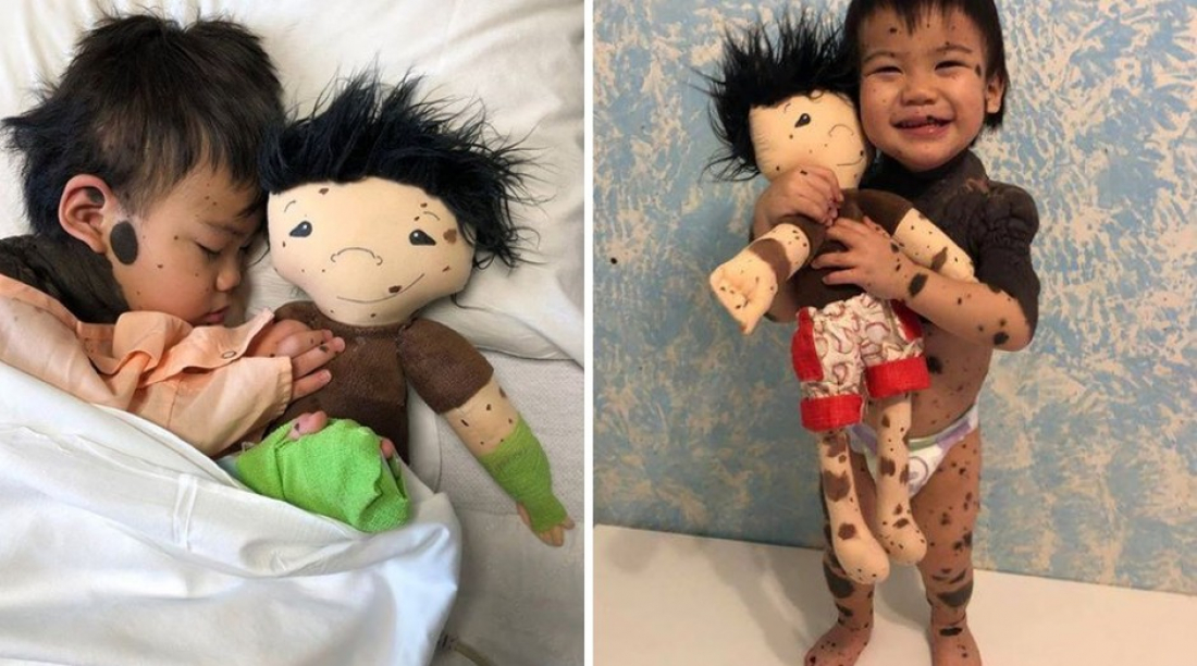 Internacional: empresária cria bonecas personalizadas para crianças com deficiências em condições raras