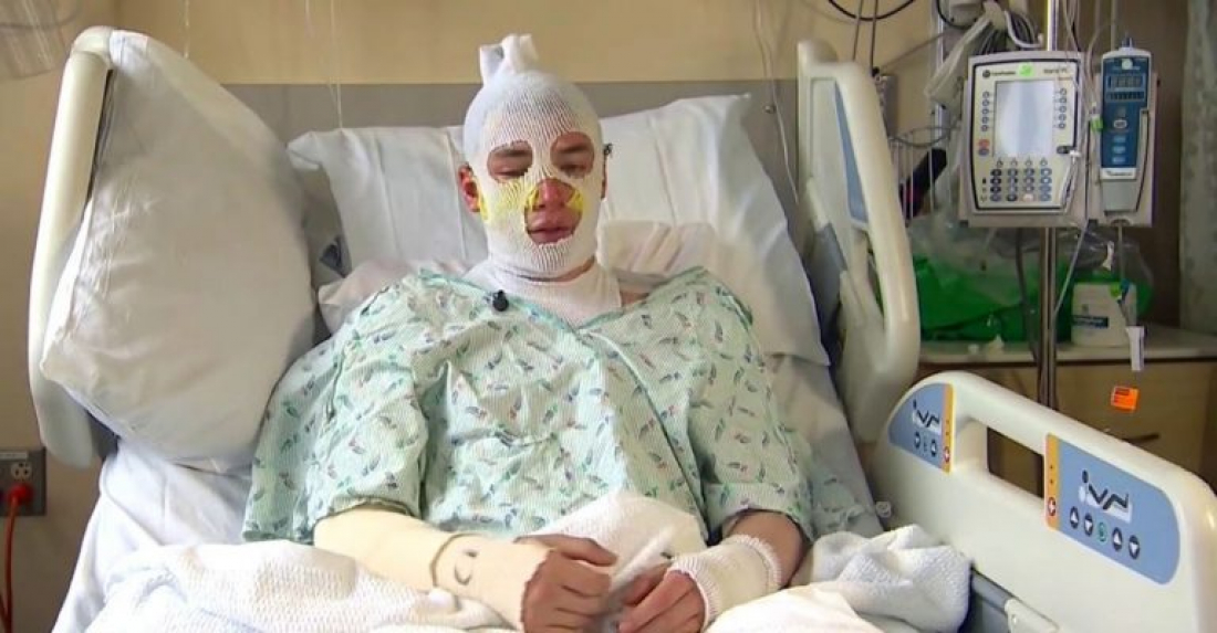 Internacional: Jovem invade casa em chamas para salvar sobrinha de 8 anos: ‘faria de novo, mesmo se eu morresse’