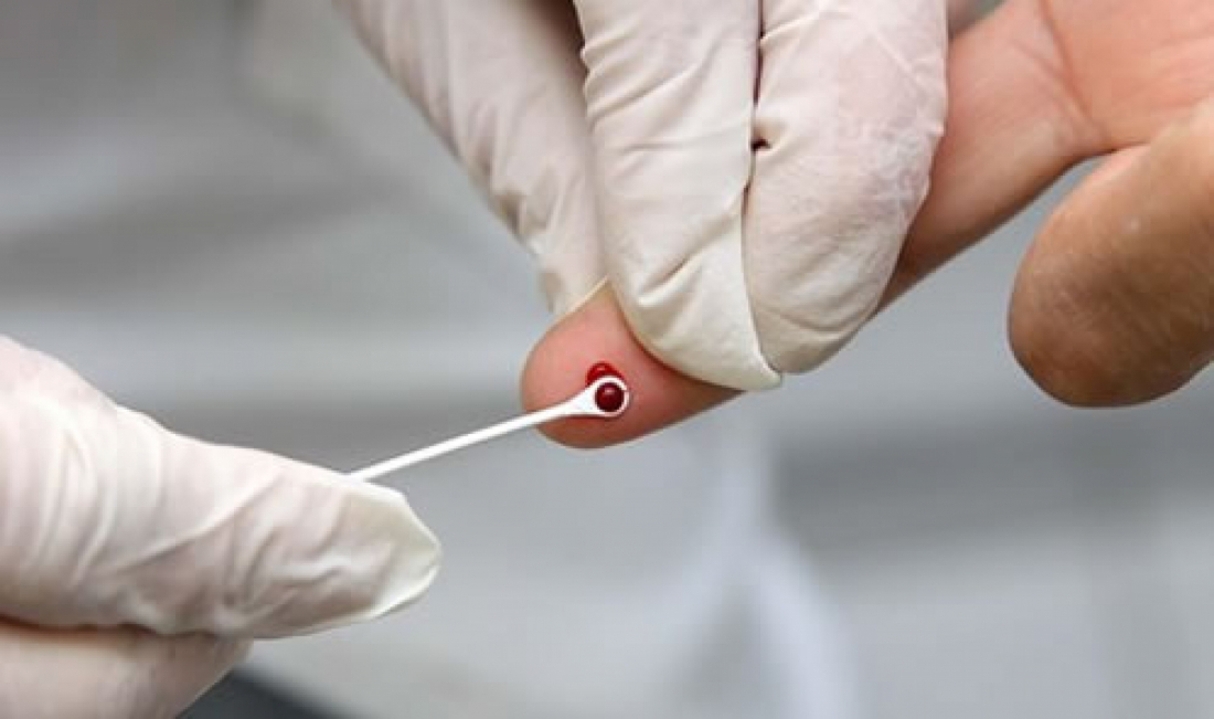 Dia Mundial de Luta Contra as Hepatites Virais é comemorado hoje