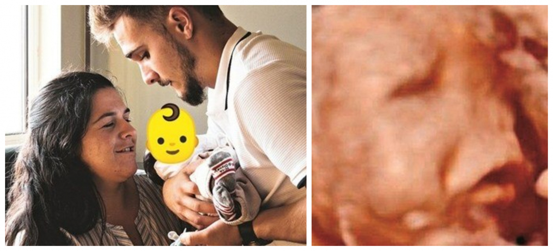 Pais Mostram Bebe Que Nasceu Sem Rosto Em Portugal Pais Mostram Bebe Que Nasceu Sem Rosto Em Portugal