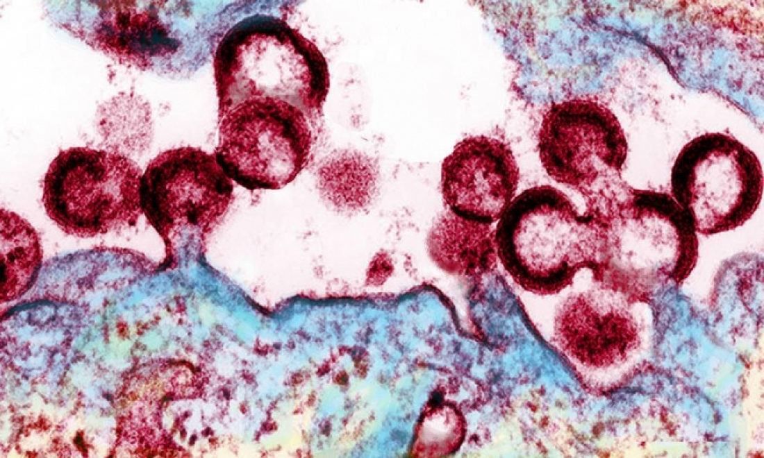 Cientistas descobrem 'caminho' para eliminar HIV totalmente do corpo