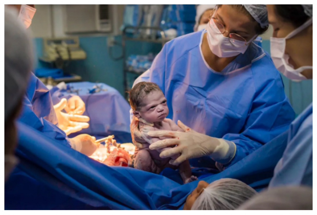 No país: bebê nasce 'brava' e foto viraliza. 'Nasceu um meme pronto', diz mãe