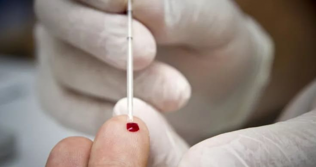 Município de Tubarão adquire 2 mil testes rápidos para detectar coronavírus