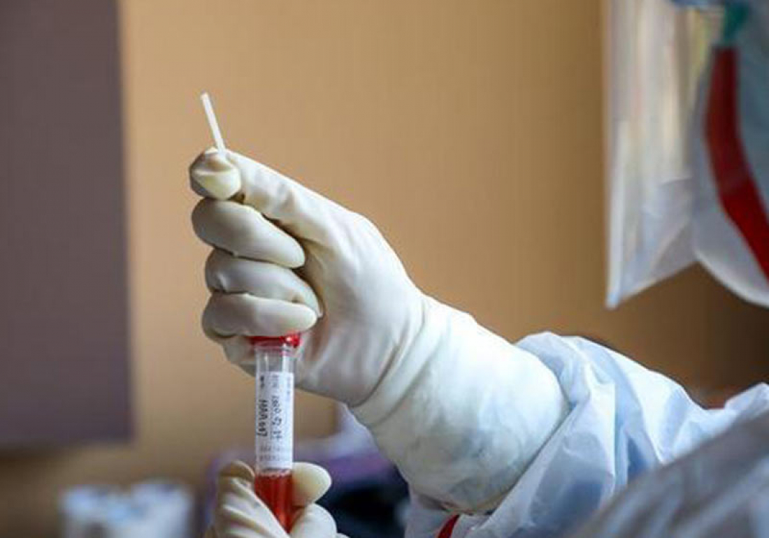 Brasil libera tratamento com sangue de quem se curou do coronavírus