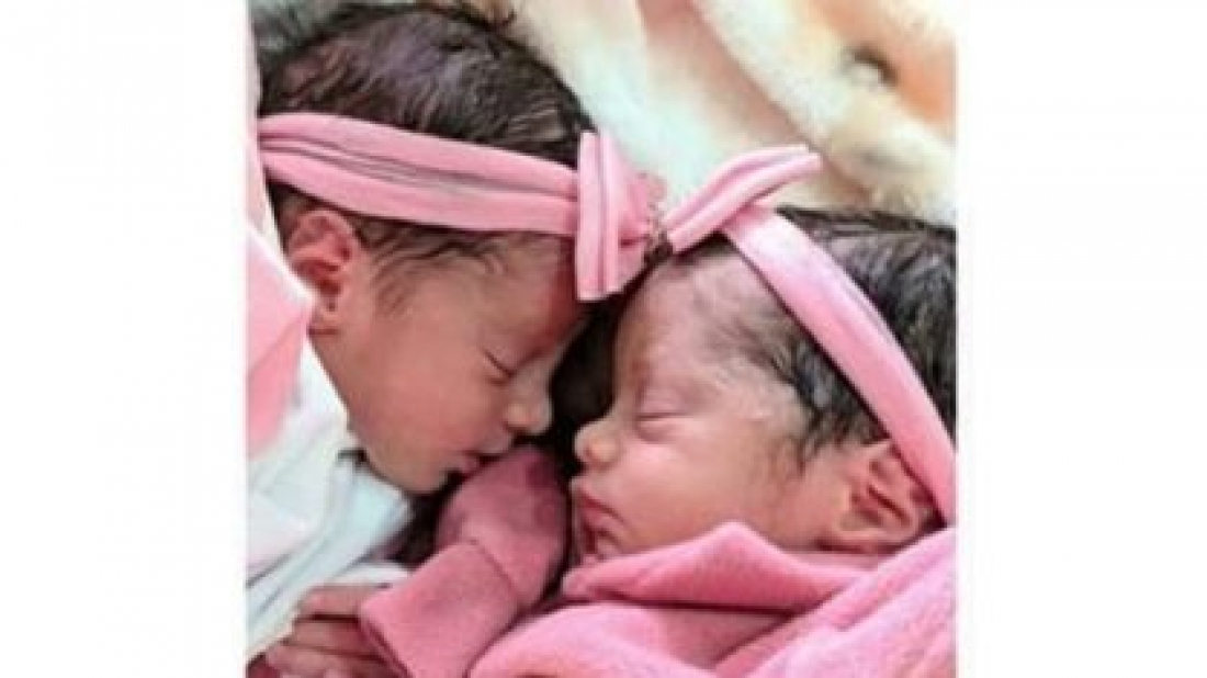 No país: Gêmeas recém-nascidas morrem após serem atacadas por cachorro da família