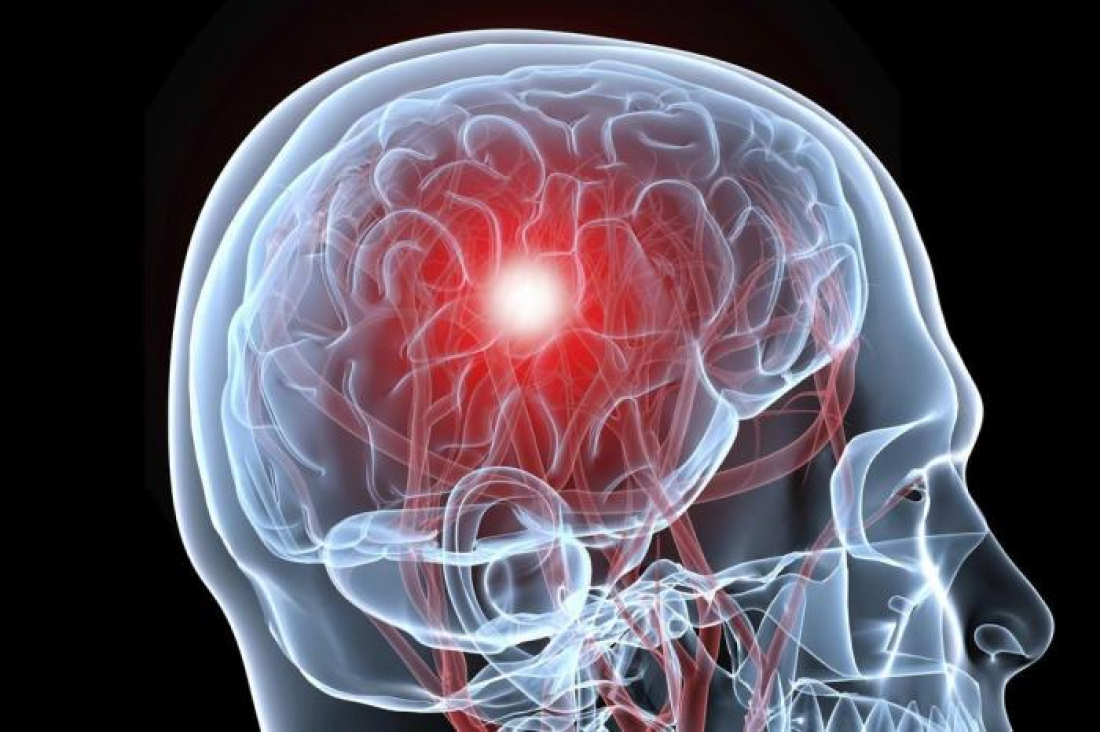 Estudo brasileiro aponta que covid-19 pode causar danos cerebrais