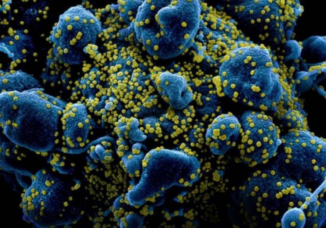 Pesquisadores da USP descobrem hormônio que cria barreira contra Covid-19