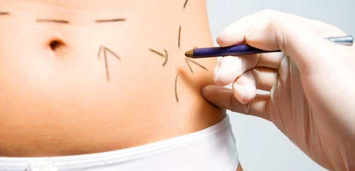 Obesidade: HNSC promove encontro nesta quarta-feira (29) #Saúde