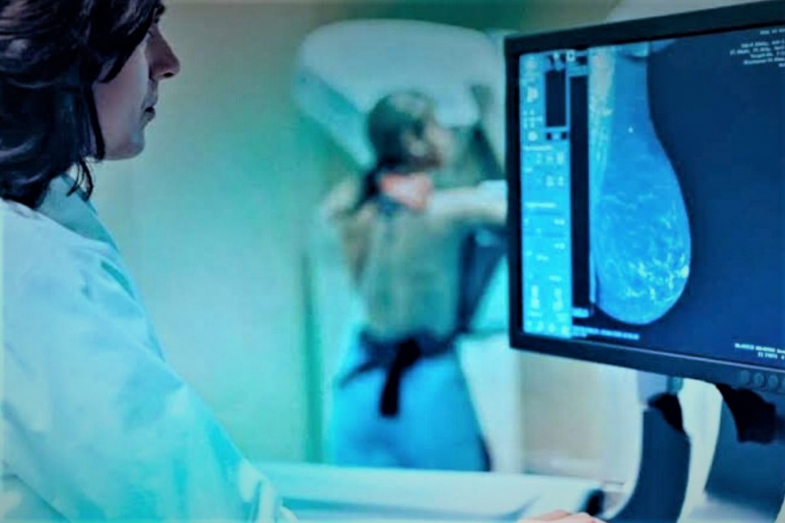 Capivari de Baixo zera fila de mamografias no Mês das Mulheres