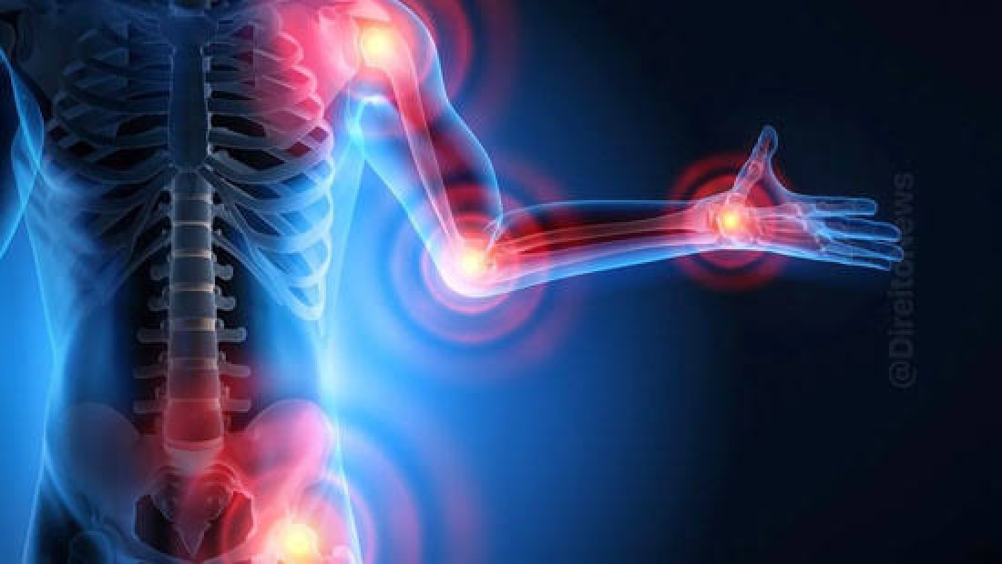 Tubarão receberá R$ 300 mil para ampliar os serviços de tratamento à fibromialgia