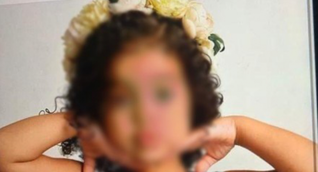 No País: criança de 6 anos tem 60% do corpo queimado após pai atear fogo em apartamento