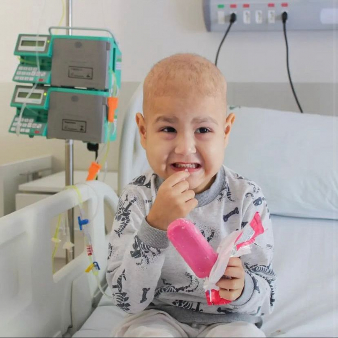 Picolé auxilia no tratamento de mucosite em crianças da oncologia pediátrica