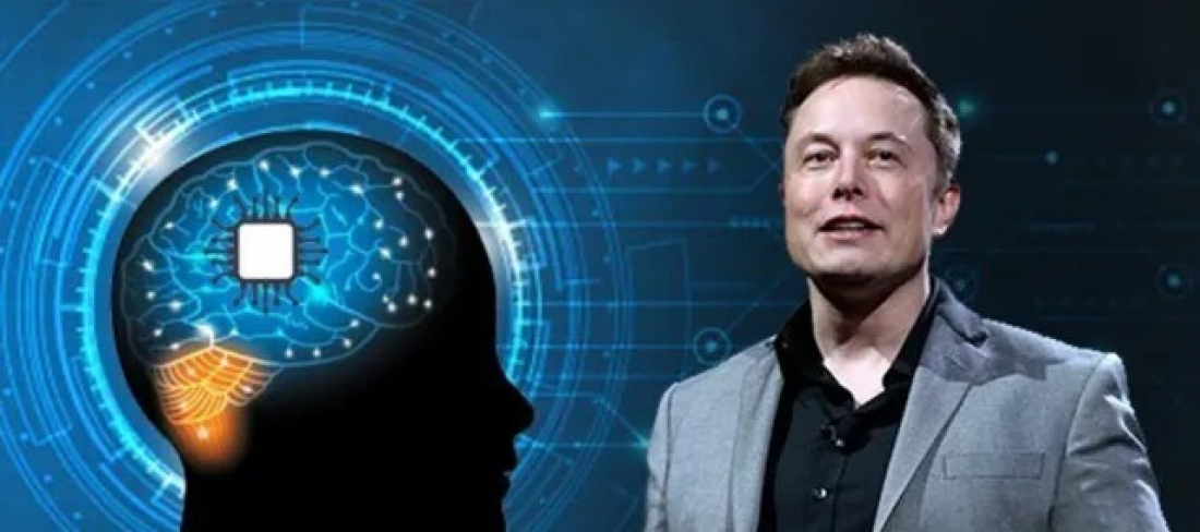 Mundo: empresa de Elon Musk faz 1º implante de chip cerebral em humano