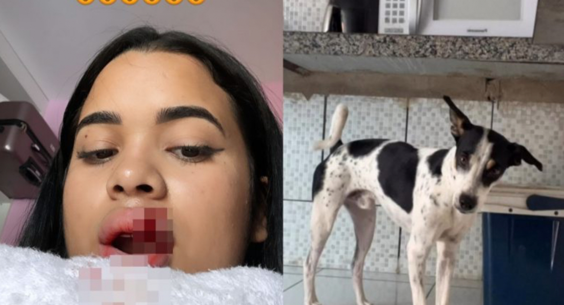 No País: Influencer tem parte do lábio arrancado após tentar beijar cachorro