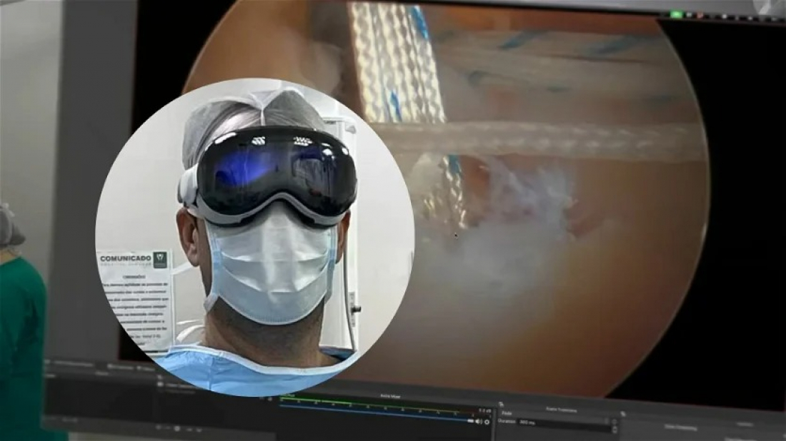 Médico catarinense utiliza Apple Vision Pro para realizar cirurgia 