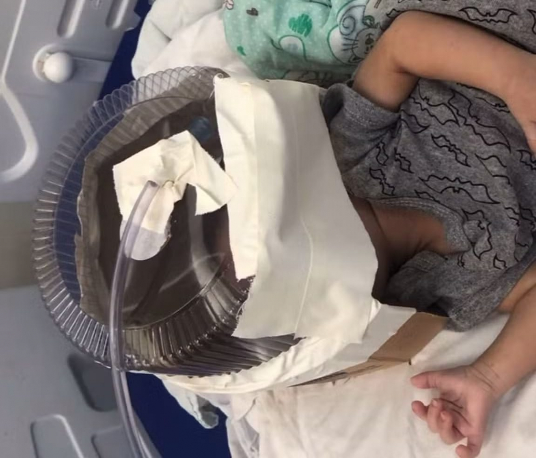 Hospital usa embalagem de bolo como máscara de oxigênio em bebê de 3 meses que esperava UTI no RN