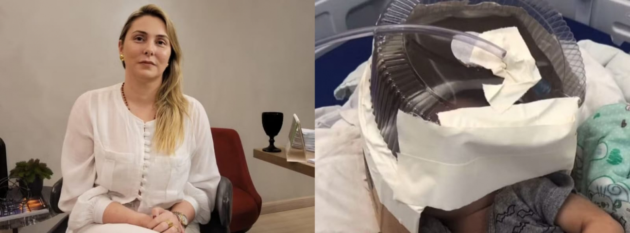 Brasil: 'Mais comum do que se imagina', diz médica que improvisou 'respirador' para bebê de 3 meses no RN