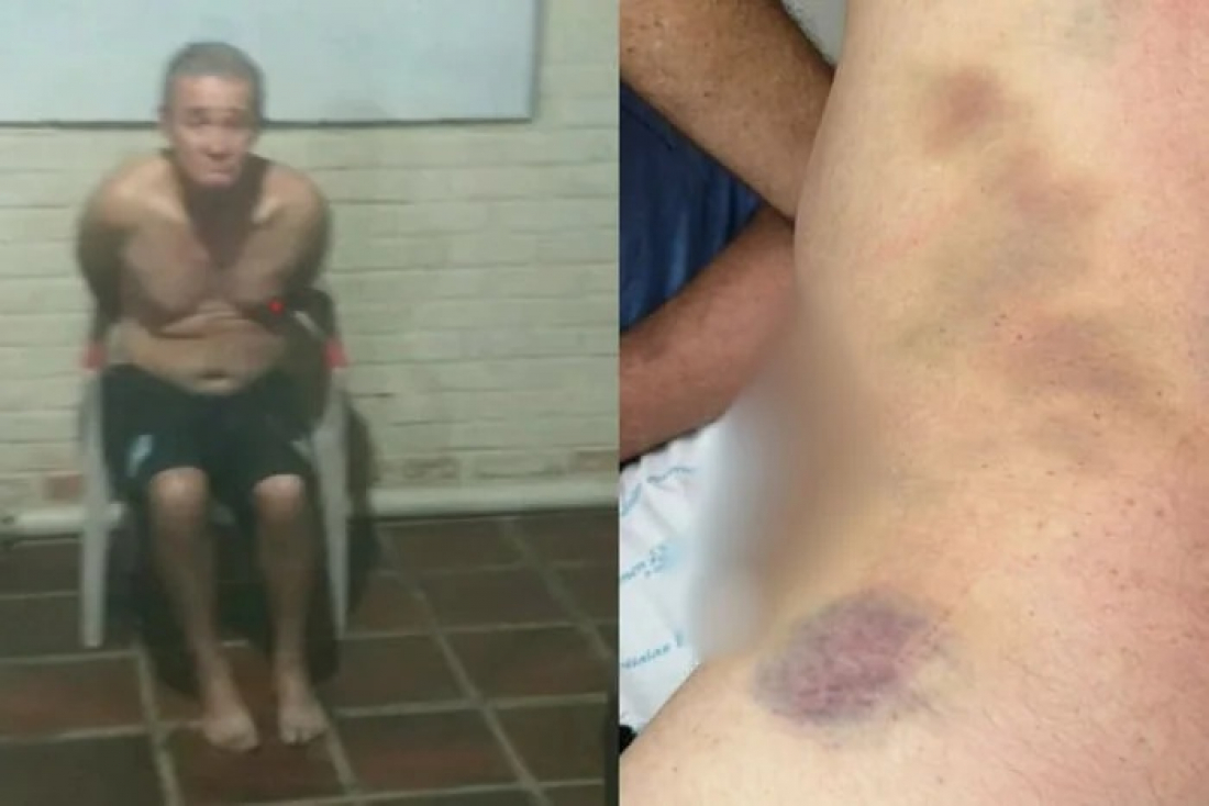 Brasil: paciente morre após ser amarrado e espancado por monitor em clínica 