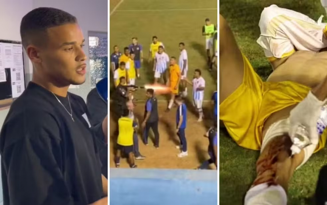 Brasil: policial atira em goleiro em jogo da segunda divisão goiana