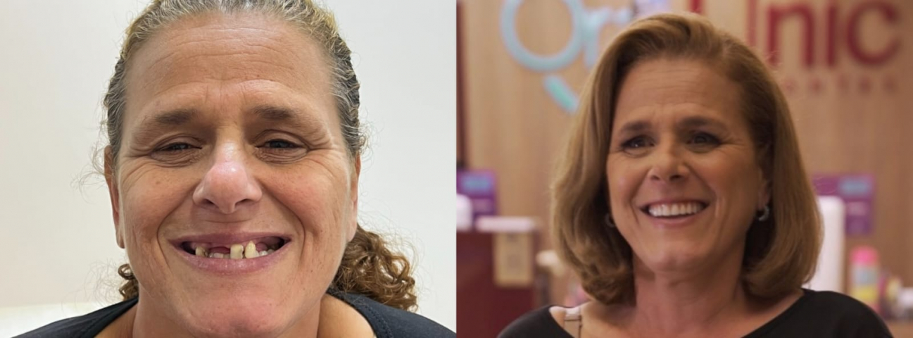 'Não tinha vontade de viver': paciente tem sorriso transformado por equipe odontológica de Tubarão