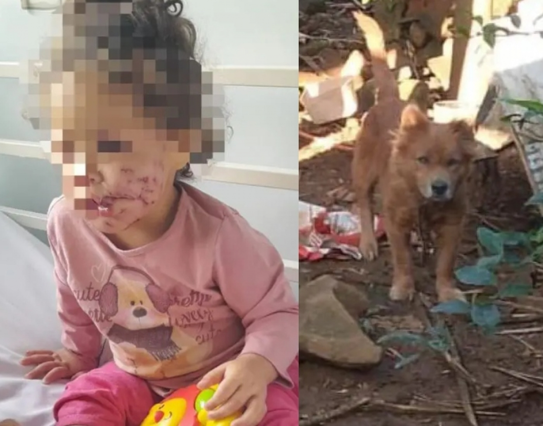 Bebê fica gravemente ferido após sofrer ataque de cão em SC