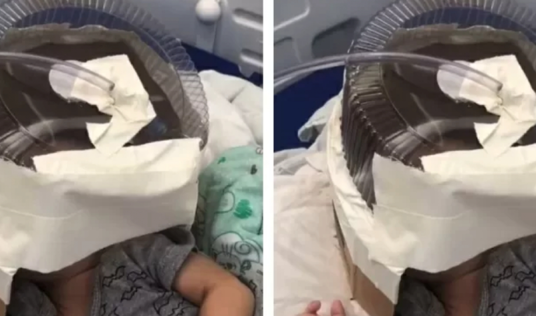 No país: morre bebê que usou respirador feito com embalagem de bolo no RN