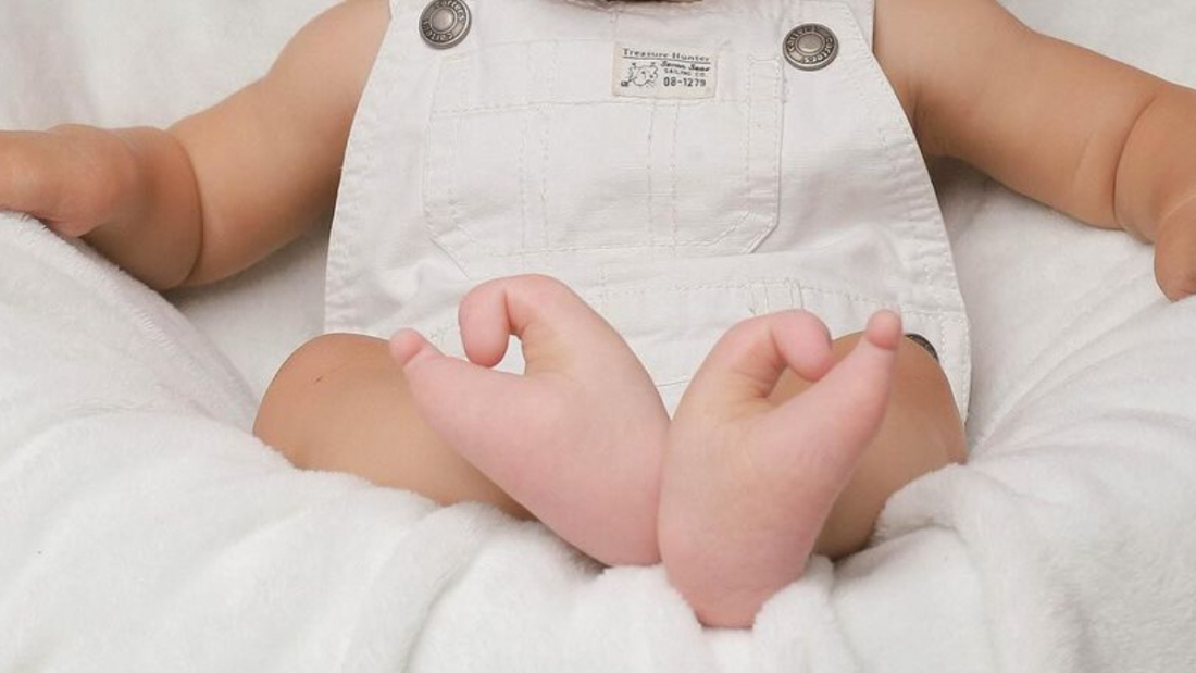 Brasil: entenda o caso do bebê que nasceu com pés de coração