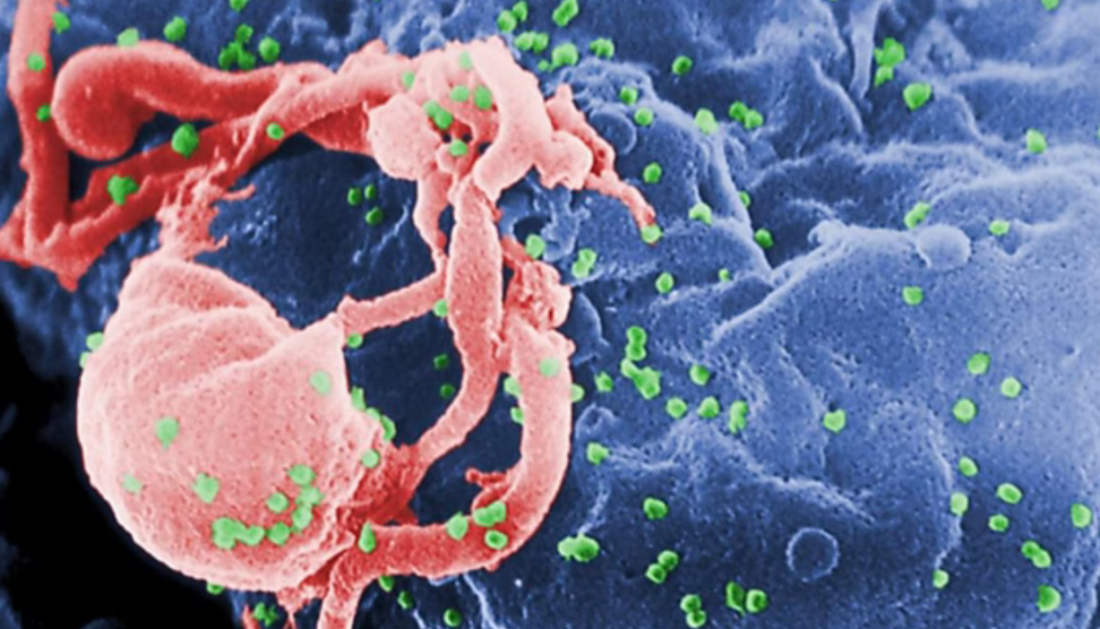 Nova variante do HIV circula em três estados do Brasil, diz estudo