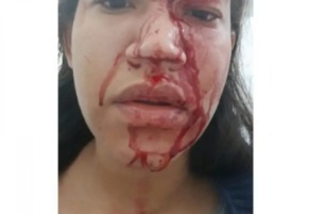 Assaltante agride mulher após ela perceber que arma era falsa no Sul de SC