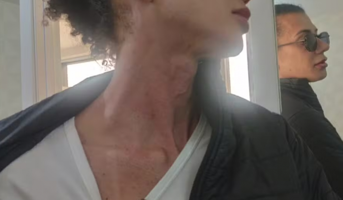 Em SC: Passageira diz que levou soco de motorista de app após erro em endereço