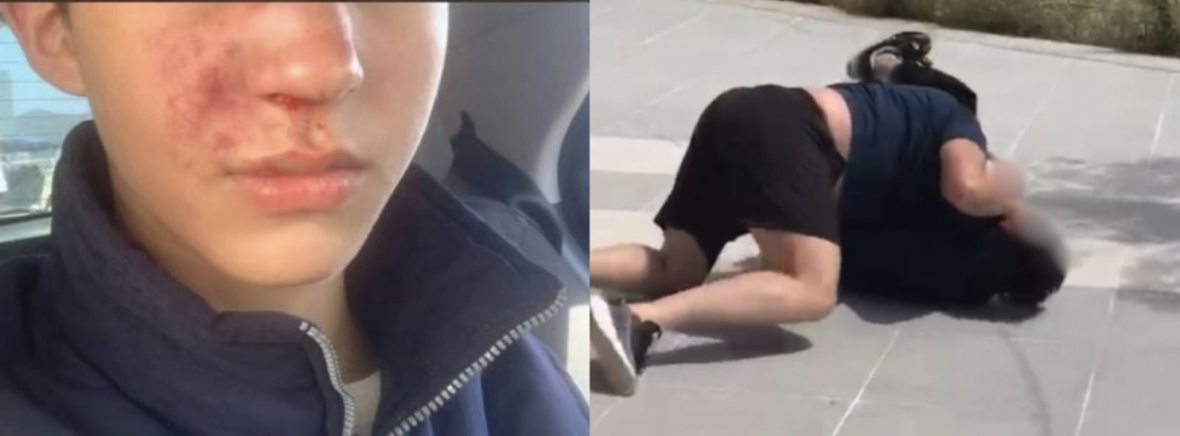 Em SC: idoso ataca e quebra nariz de adolescente com skate na orla de Balneário Camboriú