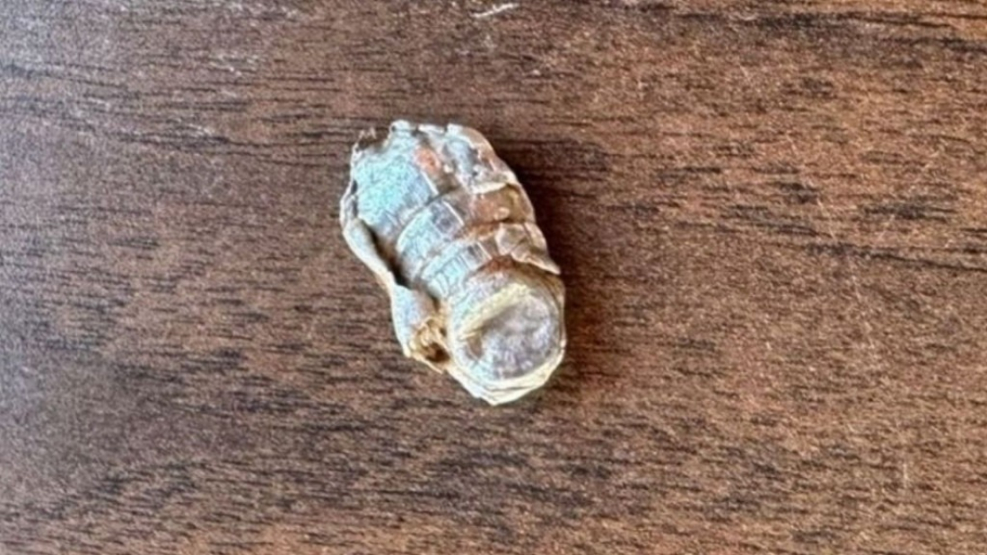 Criança de 4 anos é atingida na cabeça por bala perdida em SC