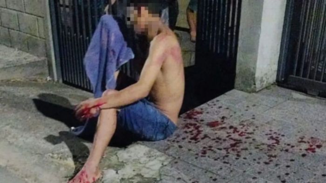 Orleans: homem fica gravemente ferido após ser agredido por quatro pessoas