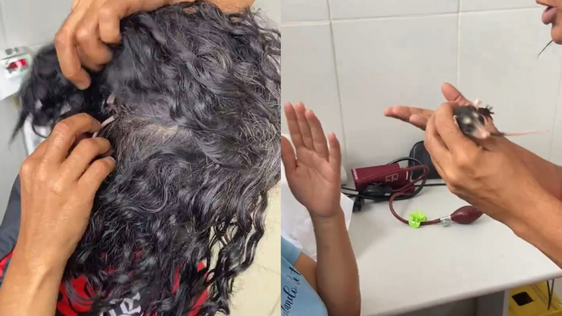 Brasil: mulher choca ao carregar filhote de gambá de estimação no cabelo (Vídeo)