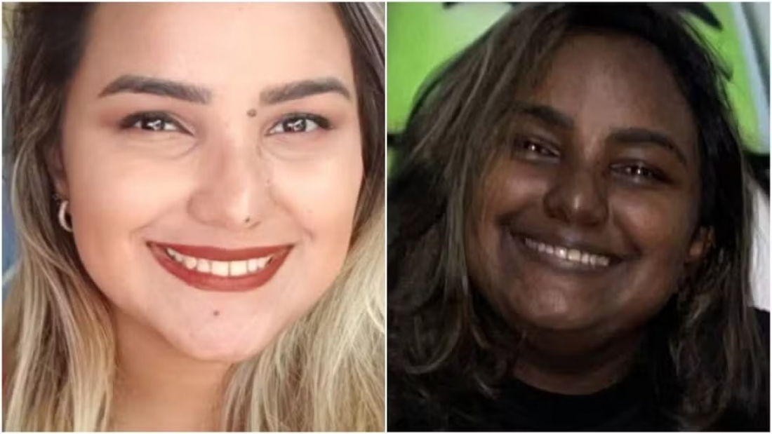 Jovem com tumor raro que levou a mudança na cor de pele busca remédio de alto custo