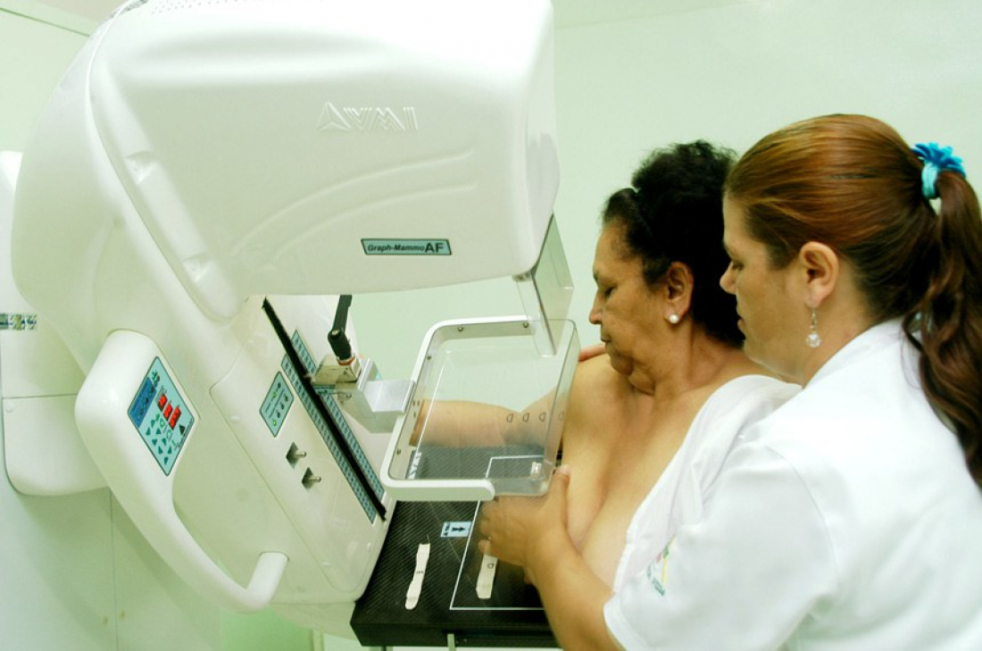 Mais de 17 mil mulheres esperam por uma mamografia pelo SUS em SC