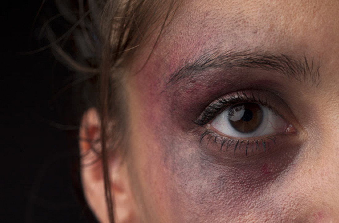 Violência doméstica em Sangão: Mulher é agredida e ameaçada pelo marido, que está foragido