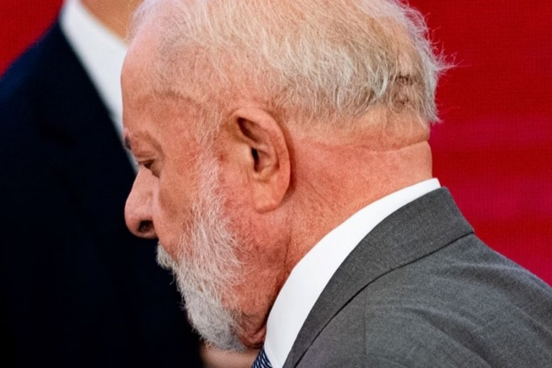 Lula fará novo procedimento cirúrgico na cabeça nesta quinta