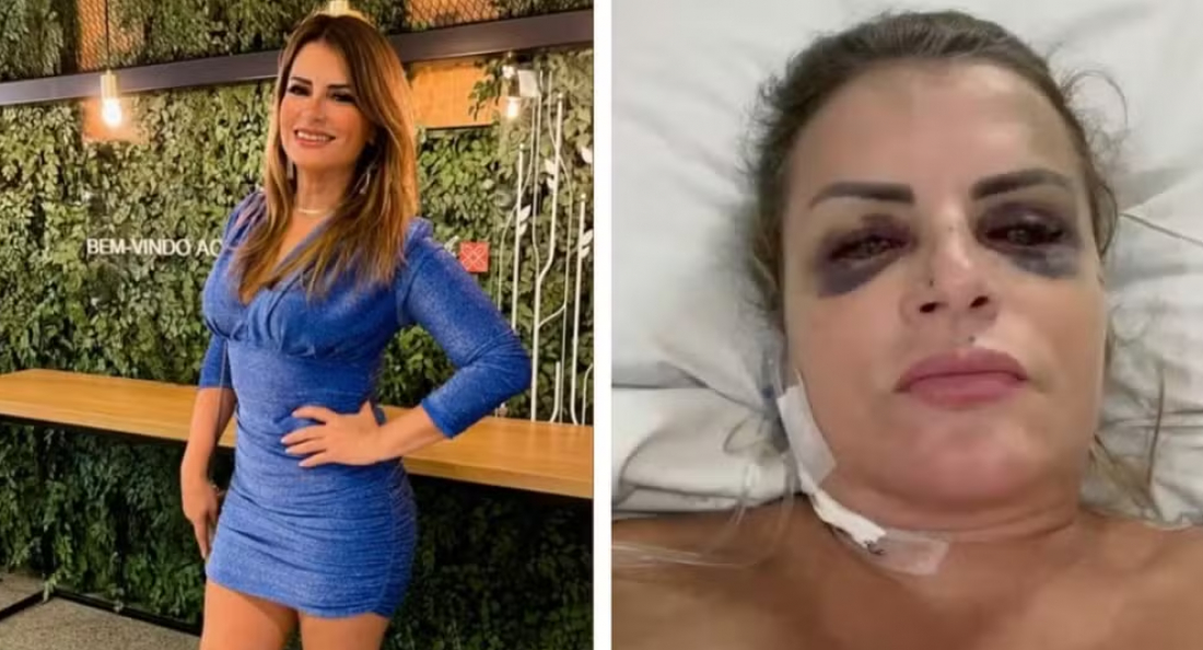 Motorista que atropelou e arrastou mulher após réveillon em Araranguá se entrega à polícia
