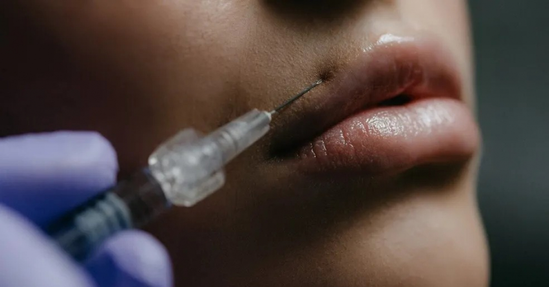 CFM pede que Anvisa proíba uso de PMMA como preenchimento